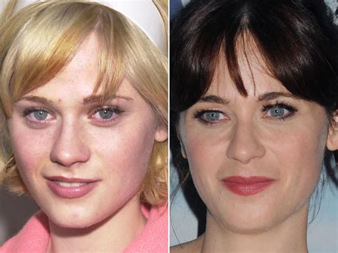 Zooey Deschanel Plastic Surgery: Facts and Myths ...